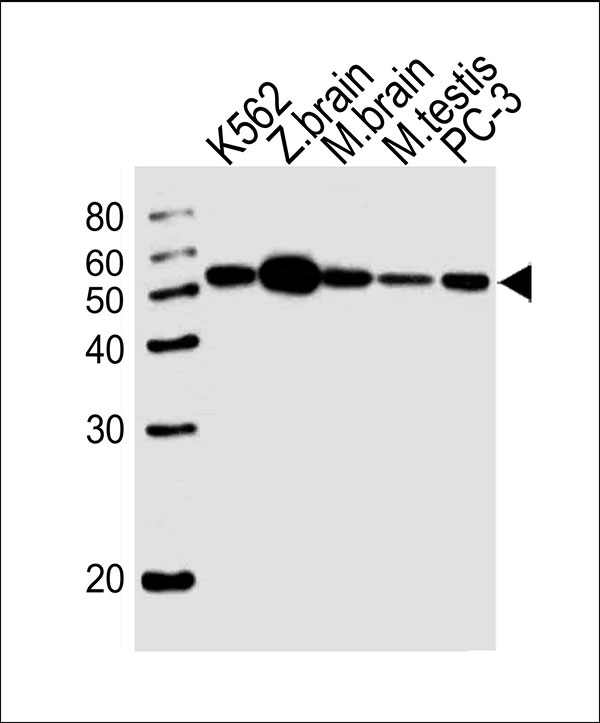 WB - DMRTA2 Antibody (C-term) AW5104-U100